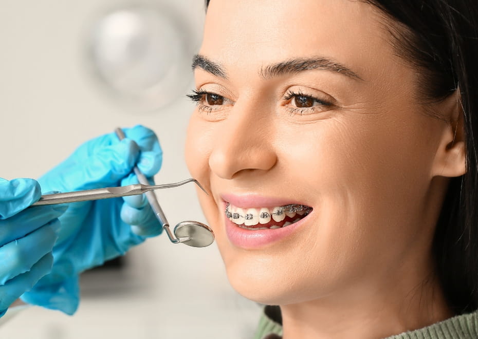 Braces & Aligners (Orthodontics)