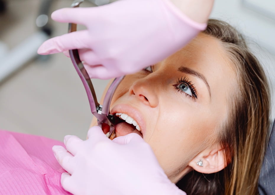 Dental Implants & Tooth Replacement